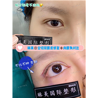 上海琳美眼综合整形
