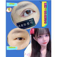 上海琳美眼综合整形