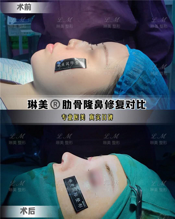 上海琳美鼻综合整形