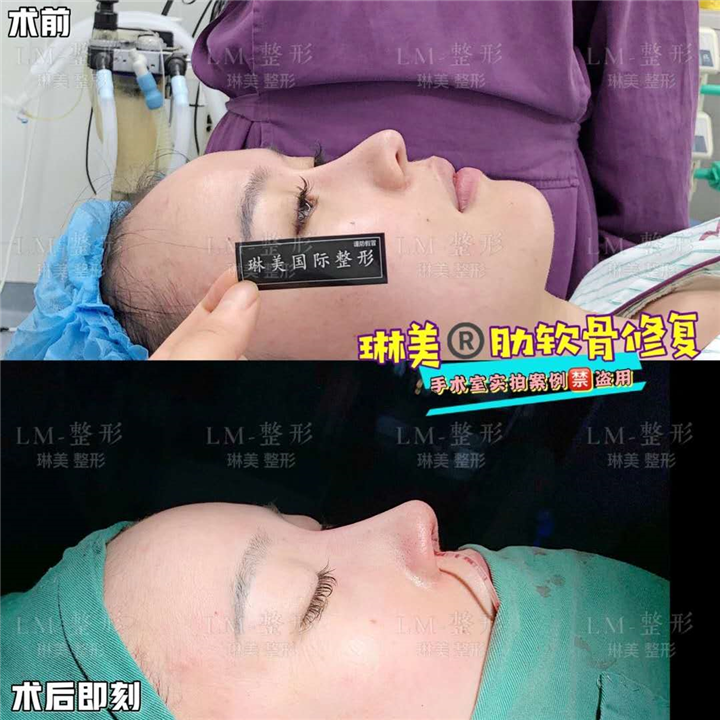 上海琳美鼻综合整形