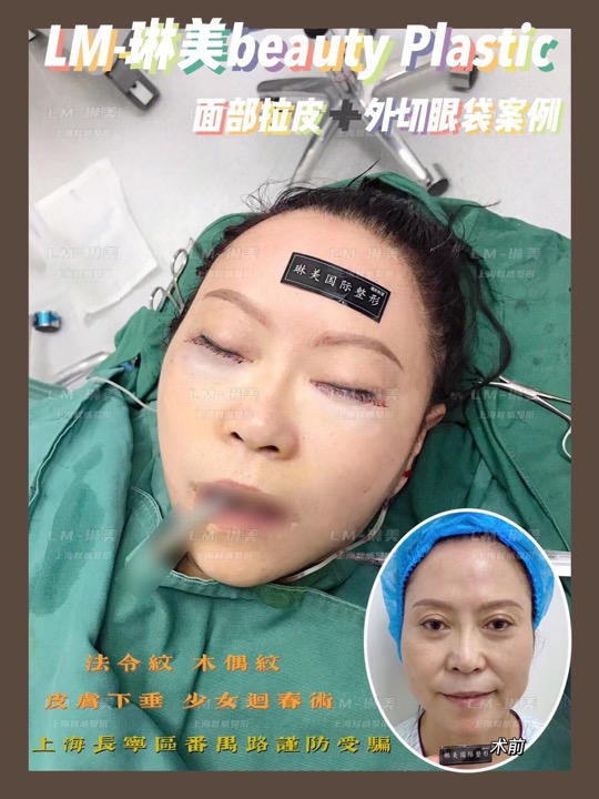 上海专业整形修复 