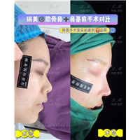 上海琳美鼻综合整形