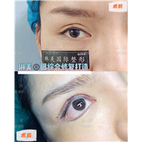 上海琳美眼综合整形