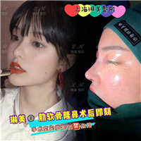 上海琳美鼻综合整形