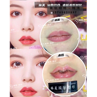 琳美M唇整形 