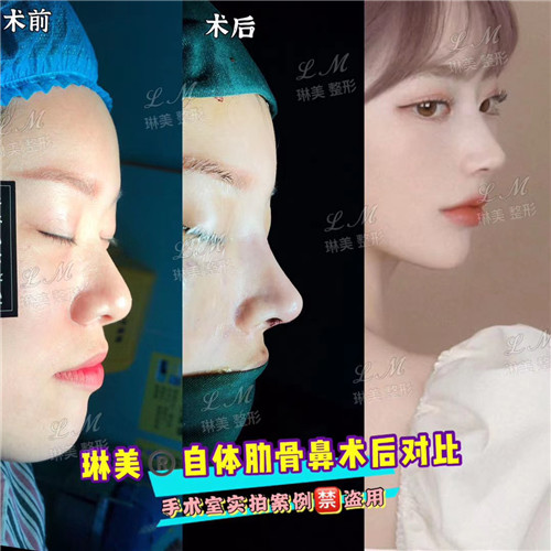 上海琳美鼻综合整形