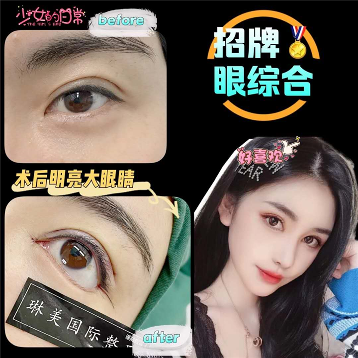 上海琳美眼综合整形