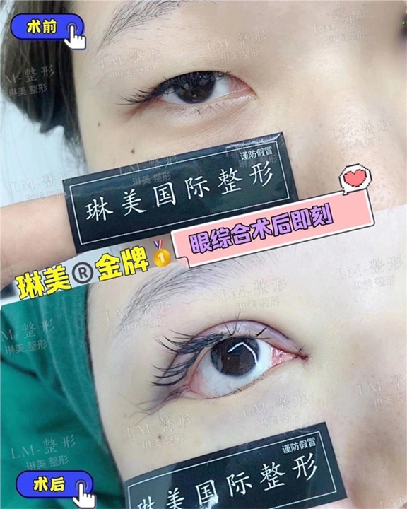 上海琳美眼综合整形