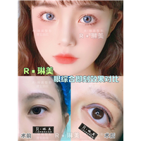 上海琳美眼综合整形