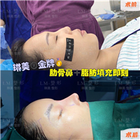 上海琳美鼻综合整形