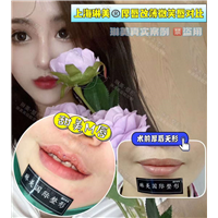 上海琳美M唇整形