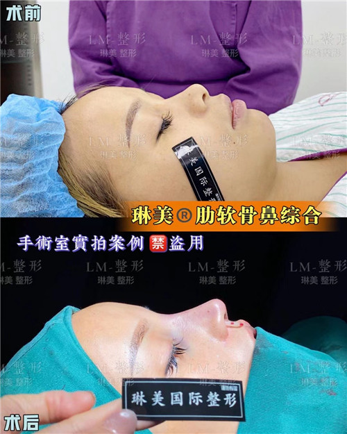上海琳美鼻综合整形