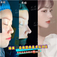 上海琳美鼻综合整形