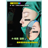 上海琳美鼻整形