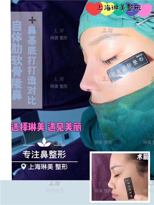 上海琳美鼻综合整形