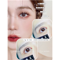琳美整形眼综合整形 