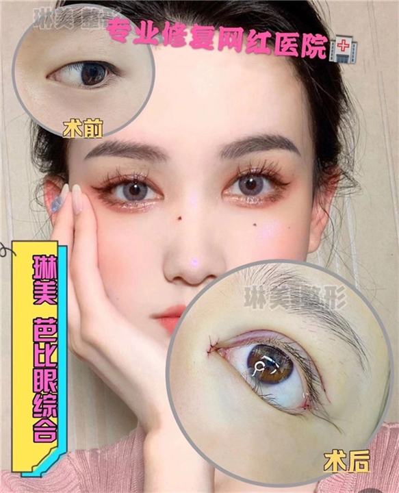 上海琳美眼综合整形