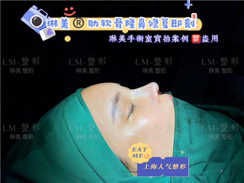 上海琳美鼻综合整形