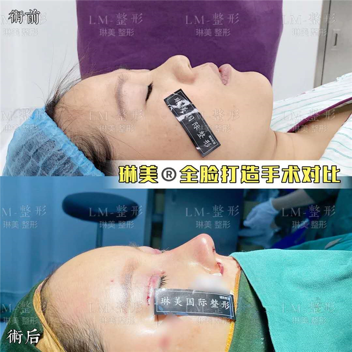 上海琳美鼻综合整形