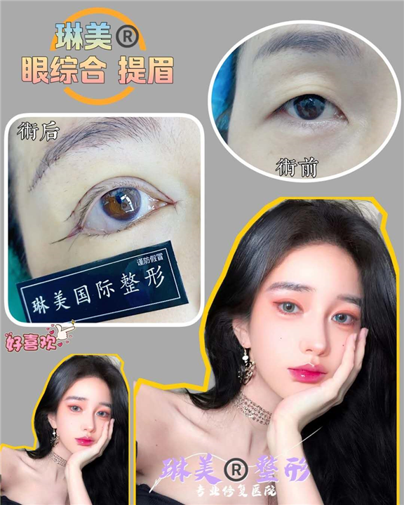 上海人气网红整形