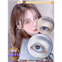 上海娜慕整形