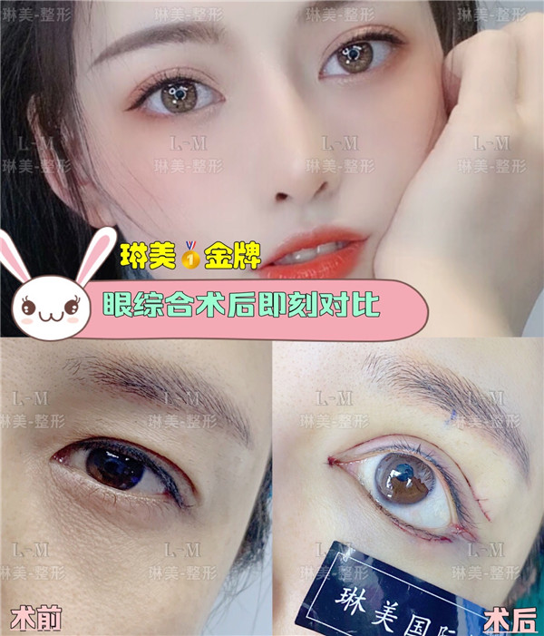 上海琳美眼综合整形