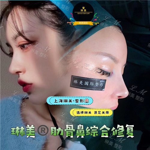 上海琳美鼻综合整形