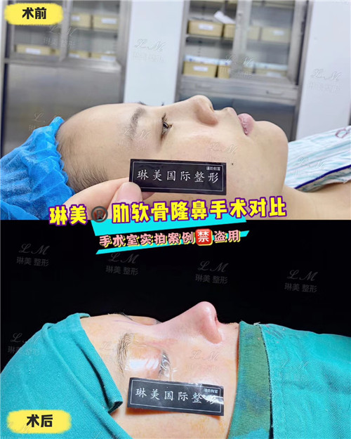 上海琳美鼻综合整形