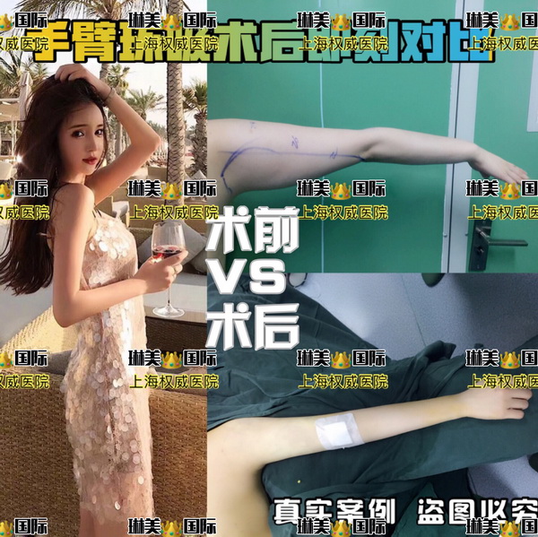 上海琳美国际整形医院