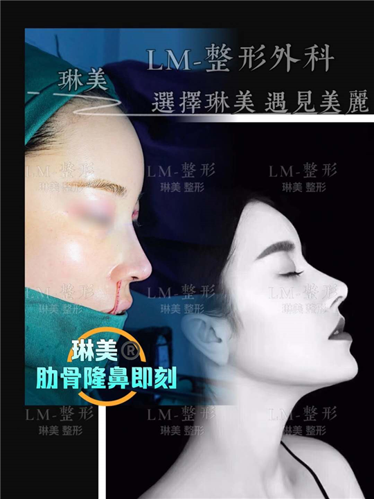 上海琳美鼻综合整形