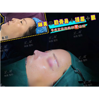 上海琳美鼻综合整形
