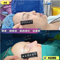 上海琳美鼻综合整形
