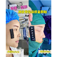 上海琳美鼻综合整形