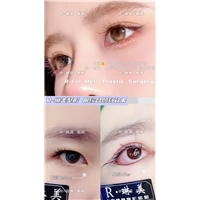 琳美眼部整形