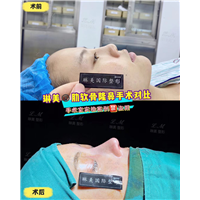上海琳美鼻综合整形