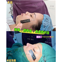 上海琳美鼻综合整形
