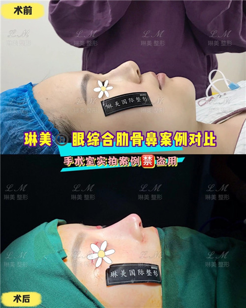 上海琳美鼻综合整形