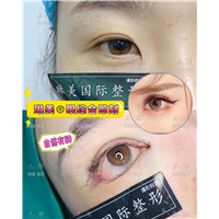 上海琳美眼综合整形