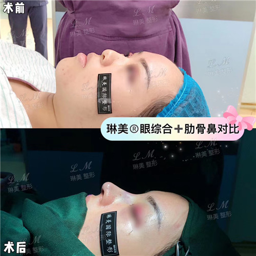 上海琳美鼻综合整形