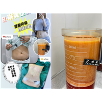 上海琳美吸脂整形