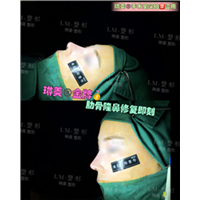 上海琳美鼻综合整形 