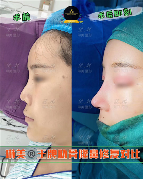 上海琳美鼻综合整形