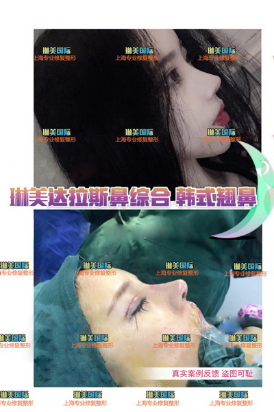 上海琳美国际整形地址