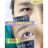 上海琳美眼综合整形