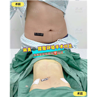 上海琳美吸脂整形
