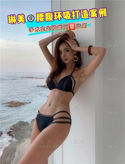 上海琳美吸脂瘦身
