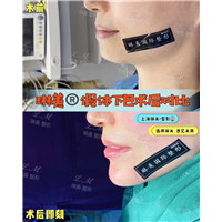 上海琳美下巴整形