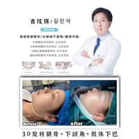 琳美磨骨整形