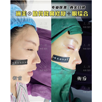 上海琳美鼻综合整形