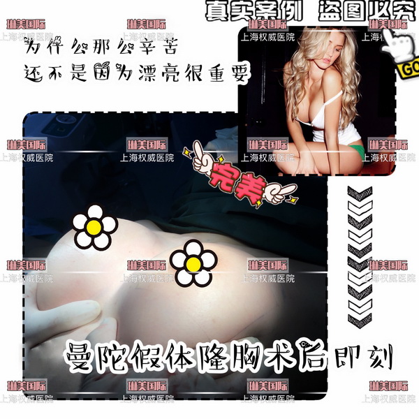 上海琳美整形|上海琳美国际整形医院